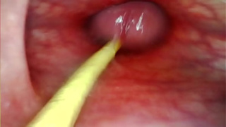 EXTREME ANAL SELF PERSPECTIVE. WEB CAMERA INSIDE HER BUTTHOLE AS I POUND HER WITH MY HUGE ROD AND SPERM DEEP INSIDE