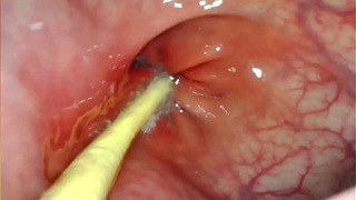 EXTREME ANAL SELF PERSPECTIVE. CAM INSIDE HER BUTTHOLE AS I POUND HER WITH MY ENORMOUS WANG AND SPUNK DEEP INSIDE